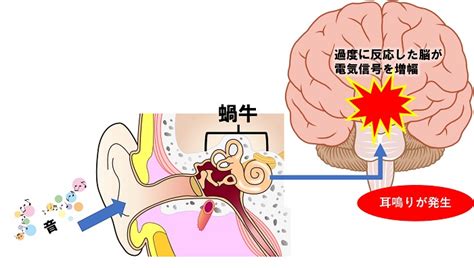 耳鳴 時間|耳鳴りとは？急ぎ受診が必要な耳鳴りの見分け方や治。